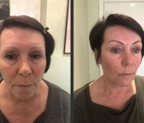 Semi Permanent - Make up by CP - Semi Permanent Eyebrows - Eyebrow - Before and after - Semi Permanent Tattoo - Make Up - Maidstone, Ashfor